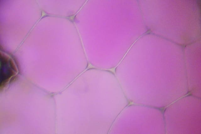 Plant cells seen down a microscope: large pink cells packed together like paving stones, separated by thin pale cell walls.