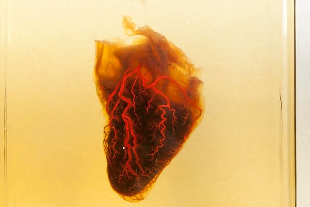 A goat’s heart preserved in a jar, with its own blood vessels filled with red dye so they stand out across its surface.