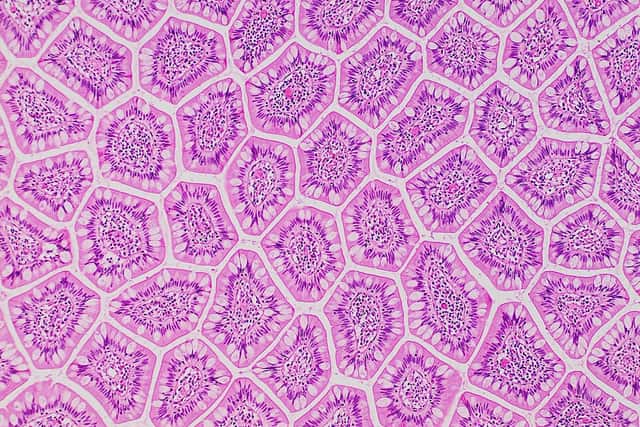 A stained microscope section packed with rounded purple-and-pink shapes, each a villus cut across, separated by pale gaps.
