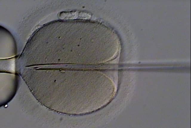 A single human egg cell seen under a microscope in a fertility clinic: a large round cell held by a glass tube on the left, with a fine needle entering it from the right.