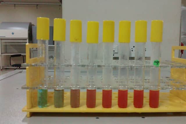 A rack of test tubes after Benedict’s test, coloured from blue-green through brown and orange to brick-red.