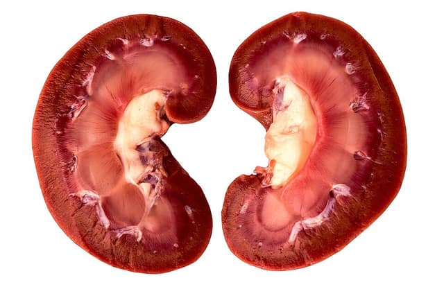 A lamb’s kidney cut in half lengthways: a dark red outer layer, a paler striped middle layer and a white central cavity.
